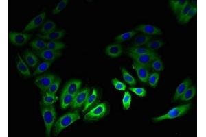 Immunofluorescent analysis of HepG2 cells using ABIN7158219 at dilution of 1:100 and Alexa Fluor 488-congugated AffiniPure Goat Anti-Rabbit IgG(H+L) (LSMEM2 Antikörper  (AA 1-96))