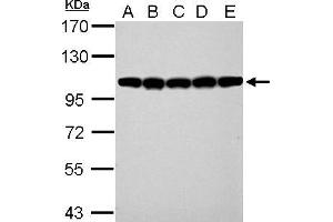 WB Image CSE1L antibody detects CSE1L protein by western blot analysis. (Exportin 2 Antikörper  (Center))