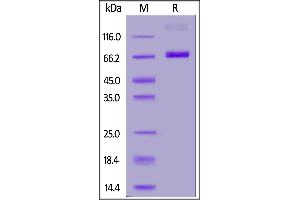SDS-PAGE (SDS) image for CD38 (AA 43-300) (Active) protein (Fc Tag,FITC) (ABIN6972987)
