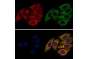 ABIN6258782 and ABIN6273627 staining Hela cells by IF/ICC. (FGF8 Antikörper  (Internal Region))