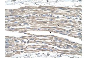 GPR161 antibody was used for immunohistochemistry at a concentration of 4-8 ug/ml to stain Skeletal muscle cells (arrows) in Human Muscle. (GPR161 Antikörper  (Middle Region))