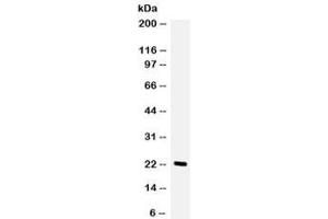 Western blot testing of human HeLa cell lysate with GCSF antibody.