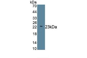 Detection of Recombinant LAMC2, Human using Monoclonal Antibody to Laminin Gamma 2 (LAMC2) (LAMC2 Antikörper  (AA 28-196))