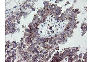 Image no. 2 for anti-Platelet/endothelial Cell Adhesion Molecule (PECAM1) antibody (ABIN1497246) (CD31 Antikörper)