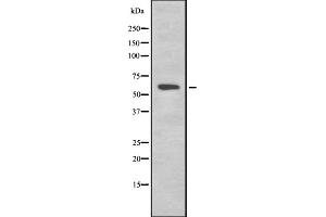 Western blot analysis of K2C1B expression in HEK293 cells ,The lane on the left is treated with the antigen-specific peptide. (Keratin 77 Antikörper  (Internal Region))