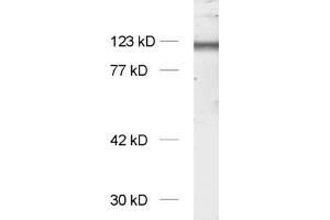 dilution: 1 : 1000, sample: synaptic membrane fraction of rat brain (LP1) (NMDA 1 Receptor Antikörper  (AA 35-53))