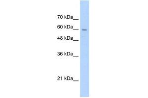 WB Suggested Anti-SLC22A1 Antibody Titration:  2. (SLC22A1 Antikörper  (N-Term))