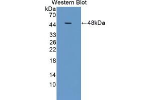 Western Blotting (WB) image for anti-Transforming Growth Factor, beta Receptor II (70/80kDa) (TGFBR2) (AA 209-590) antibody (ABIN7440968)