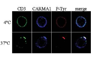 Immunocytochemistry analysis of CARMA1 using anti-CARMA1, pAb (AL220) . (CARD11 Antikörper  (N-Term))