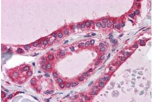 Human Thyroid: Formalin-Fixed, Paraffin-Embedded (FFPE) (WDR35 Antikörper  (N-Term))