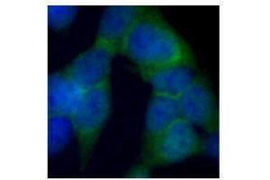 Immunofluorescence (IF) image for anti-DEAD (Asp-Glu-Ala-Asp) Box Polypeptide 1 (DDX1) antibody (ABIN2664923) (DDX1 Antikörper)