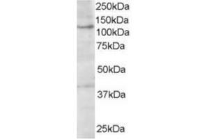 Image no. 1 for anti-Hermansky-Pudlak Syndrome 3 (HPS3) (C-Term) antibody (ABIN374450) (HPS3 Antikörper  (C-Term))