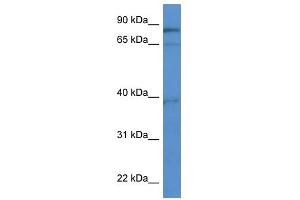 Western Blot showing ZCCHC7 antibody used at a concentration of 1-2 ug/ml to detect its target protein. (ZCCHC7 Antikörper  (C-Term))