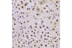 Immunohistochemistry of paraffin-embedded Mouse liver using HMGB1 antibody at dilution of 1:100 (x400 lens). (HMGB1 Antikörper  (AA 100-200))