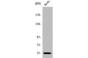 Western Blot analysis of HuvEc cells using ER81 Polyclonal Antibody (ETV1 Antikörper  (N-Term))