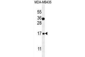 Western Blotting (WB) image for anti-S100 Calcium Binding Protein A1 (S100A1) antibody (ABIN2996370) (S100A1 Antikörper)