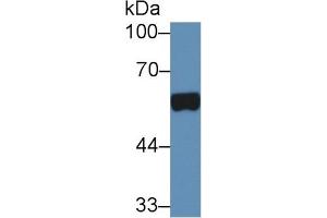 Western Blotting (WB) image for anti-Acid Phosphatase, Prostate (ACPP) (AA 56-215) antibody (ABIN7438529)