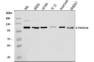 Western blot analysis of delta 1 Catenin/CAS/CTNND1 using anti-delta 1 Catenin/CAS/CTNND1 antibody (ABIN7602221). (CTNND1 Antikörper  (AA 64-930))