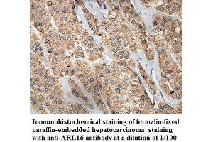 Image no. 1 for anti-ADP-Ribosylation Factor-Like 16 (ARL16) antibody (ABIN1574818) (ARL16 Antikörper)