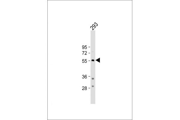 Tryptophan Hydroxylase 1 Antikörper  (N-Term)