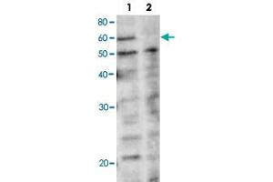 Western blot analysis of rad22 in yeast whole cell extracts.