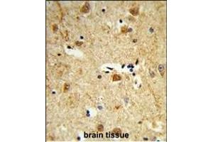 Formalin-fixed and paraffin-embedded human brain tissue reacted with DOLK Antibody (Center), which was peroxidase-conjugated to the secondary antibody, followed by DAB staining.
