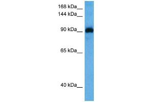 Host:  Rabbit  Target Name:  MYOCD  Sample Tissue:  Mouse Spleen  Antibody Dilution:  1ug/ml (Myocardin Antikörper  (N-Term))