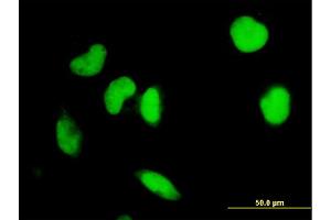 Immunofluorescence of monoclonal antibody to IRF2 on HeLa cell.