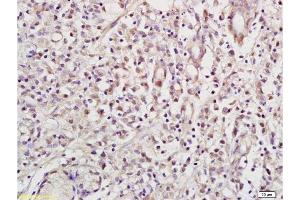 Immunohistochemistry (Paraffin-embedded Sections) (IHC (p)) image for anti-RE1-Silencing Transcription Factor (REST) (AA 401-450) antibody (ABIN747683)