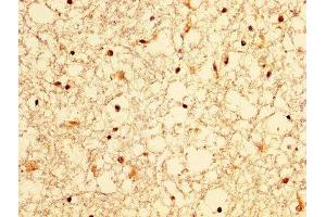 IHC image of ABIN7156316 diluted at 1:300 and staining in paraffin-embedded human brain tissue performed on a Leica BondTM system. (OCRL Antikörper  (AA 121-271))