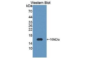 Western blot analysis of the recombinant protein. (PIM1 Antikörper  (AA 122-261))
