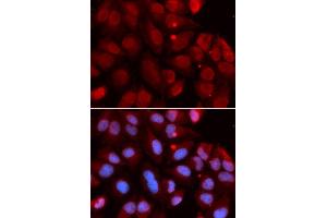 Immunofluorescence (IF) image for anti-Recombination Activating Gene 2 (RAG2) antibody (ABIN1876827) (RAG2 Antikörper)