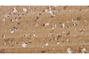 Immunohistochemistry of paraffin-embedded Human brain tissue using KCNMB2 Polyclonal Antibody at dilution 1:40 (KCNMB2 Antikörper)