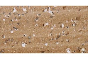 Immunohistochemistry of paraffin-embedded Human brain tissue using KCNMB2 Polyclonal Antibody at dilution 1:40