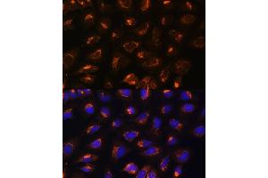 Immunofluorescence analysis of U2OS cells using MEK2 antibody (ABIN7268640) at dilution of 1:100. (MEK2 Antikörper  (AA 1-100))