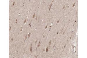 ABIN6267379 at 1/200 staining human brain tissue sections by IHC-P.