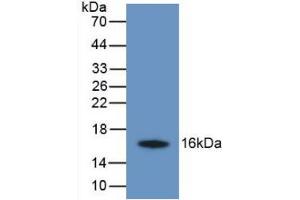Figure. (TMEM27 Antikörper  (AA 17-137))