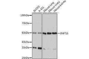 Western blot analysis of extracts of various cell lines, using BMP15 Rabbit mAb (ABIN7265896) at 1:1000 dilution. (BMP15 Antikörper)