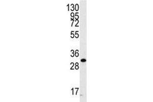 Western blot analysis of CDC2 antibody and A2058 cell lysate. (CDK1 Antikörper  (AA 213-241))