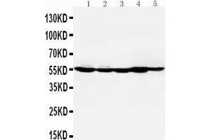 Anti-HDAC2 antibody, Western blotting Lane 1: MM453 Cell Lysate Lane 2: MCF-7 Cell Lysate Lane 3: HELA Cell Lysate Lane 4: SMMC Cell Lysate Lane 5: COLO320 Cell Lysate