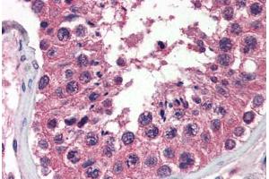 Human Testis (formalin-fixed, paraffin-embedded) stained with UNG antibody ABIN364332 at 10 ug/ml followed by biotinylated anti-mouse IgG secondary antibody ABIN481714, alkaline phosphatase-streptavidin and chromogen. (UNG Antikörper  (AA 1-313))