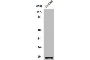 Western Blot analysis of COLO205 cells using MRLC2 Polyclonal Antibody (MYL12A Antikörper)