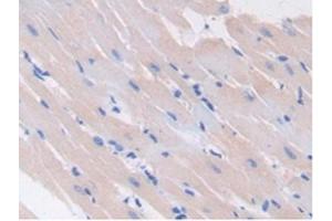 Detection of GAD2 in Rat Heart Tissue using Polyclonal Antibody to Glutamate Decarboxylase 2 (GAD2) (GAD65 Antikörper  (AA 188-374))
