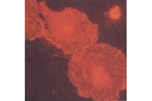 Human primary fibroblasts (MAb BB10, b3-Integrin) (Integrin beta 3 Antikörper)