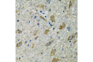 Immunohistochemistry (Paraffin-embedded Sections) (IHC (p)) image for anti-Thioredoxin 2 (TXN2) (AA 1-166) antibody (ABIN6149724)