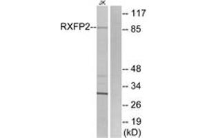 Western blot analysis of extracts from Jurkat cells, using RXFP2 Antibody. (RXFP2 Antikörper  (AA 113-162))
