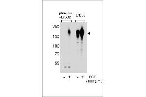 Western blot analysis of extracts from A431 cells, untreated or treated with EGF, using phospho-ERBB2- (left) or ErBB2 Antibody (right). (ErbB2/Her2 Antikörper  (pSer1107))