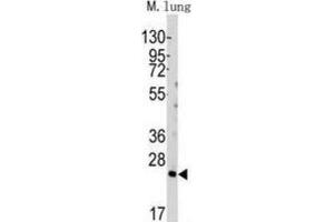 Western Blotting (WB) image for anti-BH3 Interacting Domain Death Agonist (BID) (BH3 Domain) antibody (ABIN2997129) (BID Antikörper  (BH3 Domain))