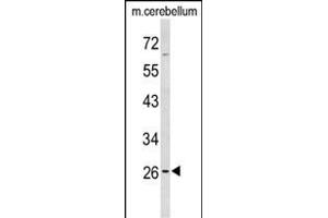 Western blot analysis of PX Antibody (Center) (ABIN653127 and ABIN2842706) in mouse cerebellum tissue lysates (35 μg/lane). (PXMP4 Antikörper  (AA 128-155))