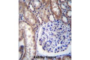 Immunohistochemistry (IHC) image for anti-Guanine Nucleotide Binding Protein (G Protein), alpha 14 (GNa14) antibody (ABIN2996930) (GNa14 Antikörper)